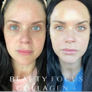 Beauty Focus Collagen + SUBSCRIPTION